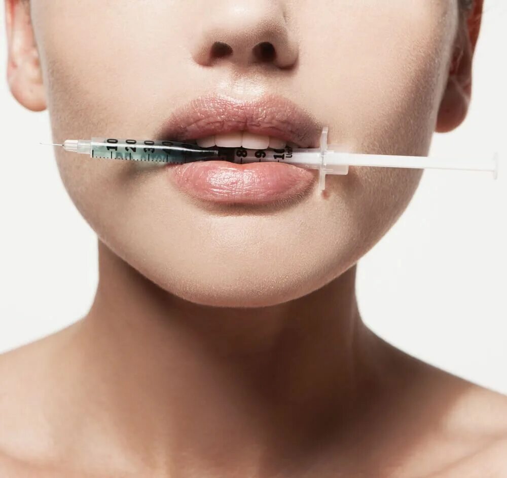 Lip filler
