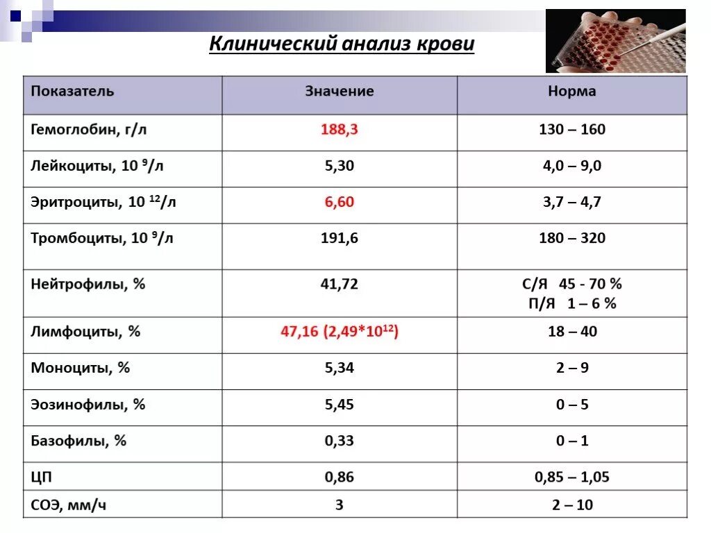 Клинический анализ крови показатели нормы. Норма исследования клинического анализа крови. Показатели анализа крови нормы гемоглобин. Общий анализ крови расшифровка гемоглобин.