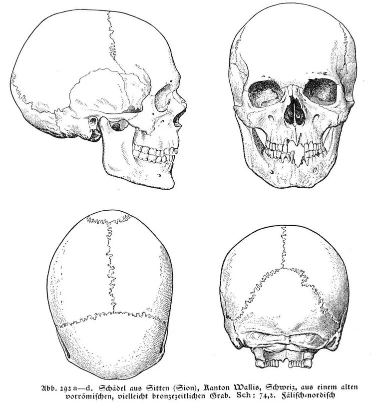 Варианты формы черепа. Форма черепа. Формы черепа человека.