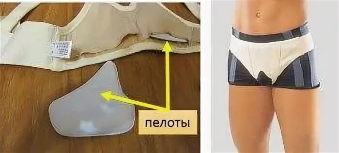 Паховая грыжа какой нужен бандаж. Бандаж для паховой-мошоночной грыжи. бандаж для паховой мошоночной грыжи мужской. послеоперационный бандаж при паховой грыже. бандаж после операции паховой грыжи у мужчин.
