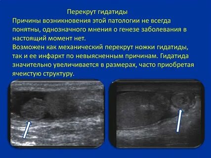 Что делать при перекруте