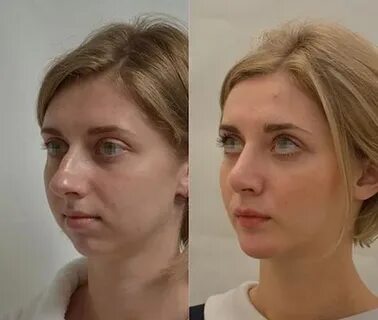 Пластические операции отзывы