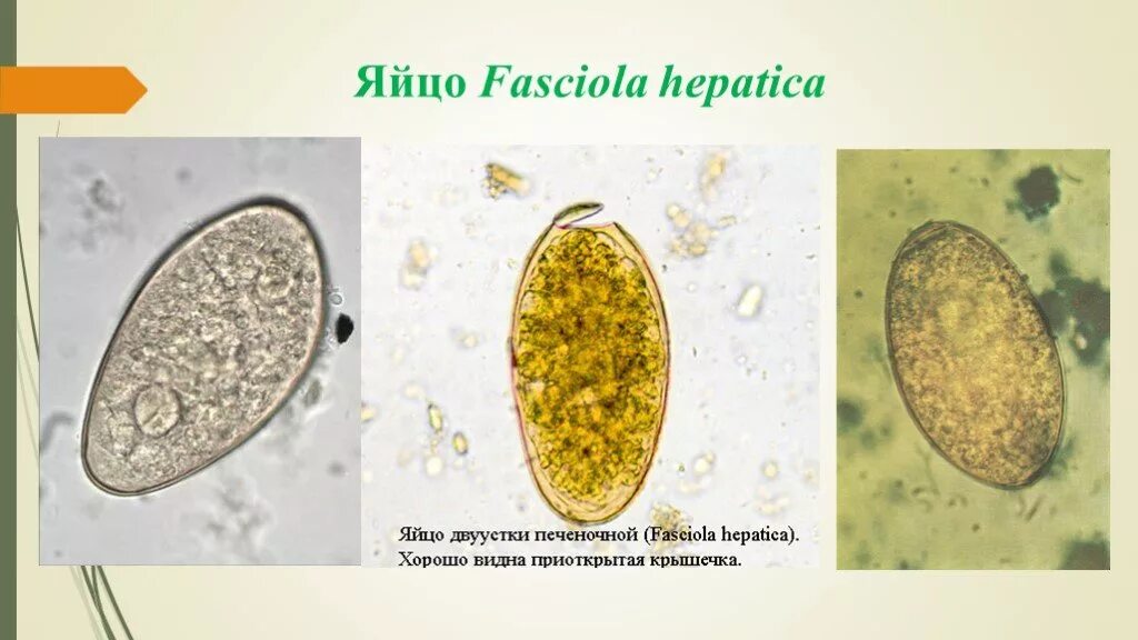 Яйца печеночного сосальщика микроскоп. Яйцо гельминта фасциолез. Яйцо фасциолы строение. Fasciola hepatica яйца. Печеночный сосальщик диагностика