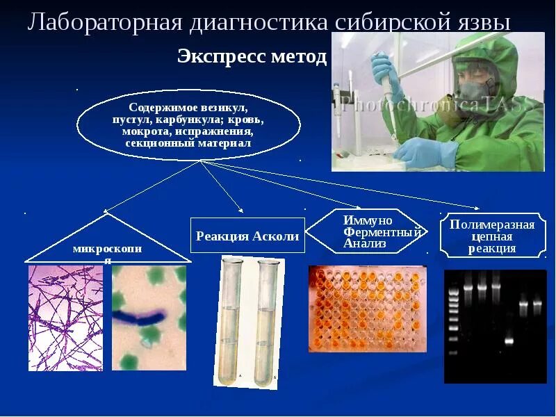 Сибирская язва лаборатория