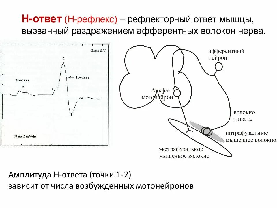 Рефлекторный ответ. Амплитуда m-ответа нерва. Амплитуда рефлекса это. Амплитуда н рефлекса в норме.