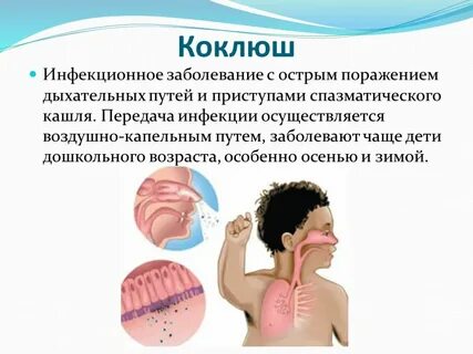 Кашель 4 инфекции