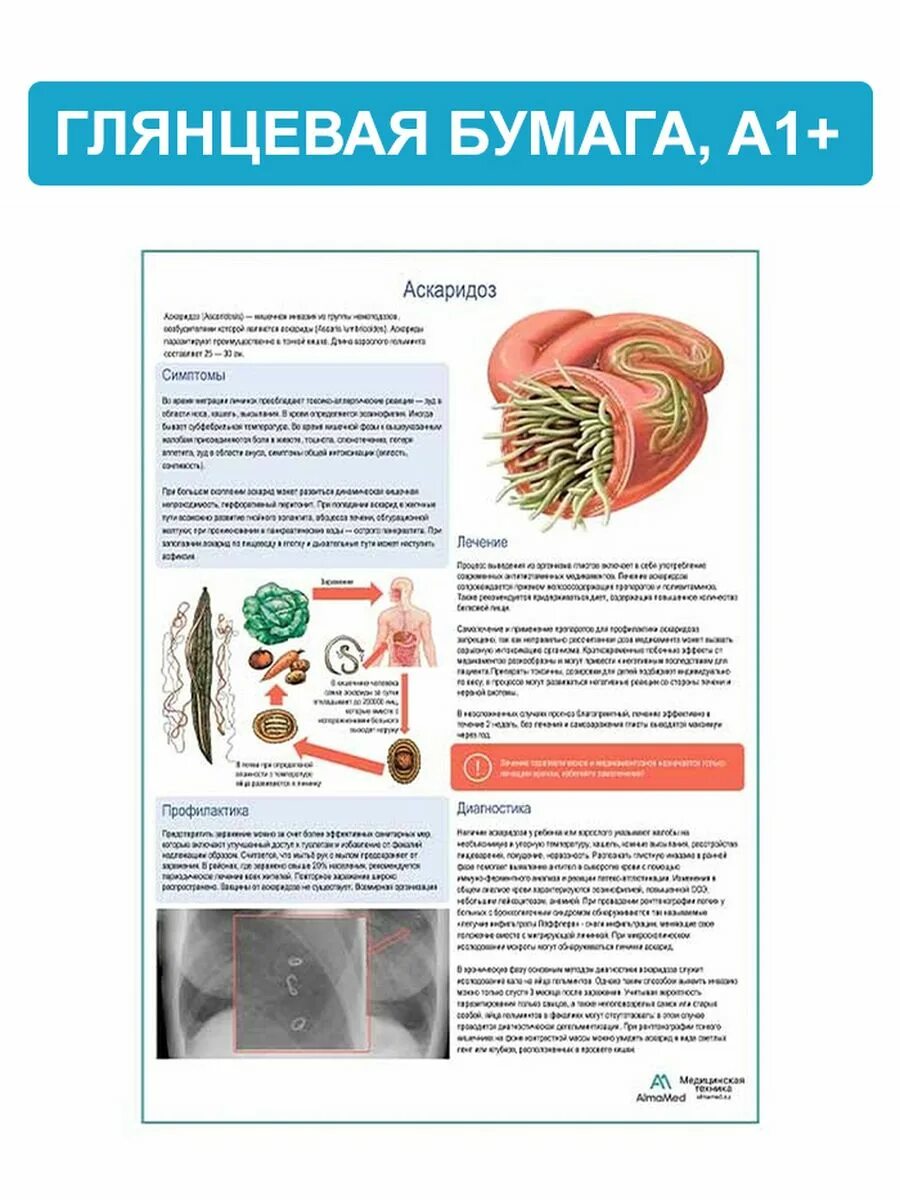 Какие продукты при аскаридозе. Аскаридоз памятка. Профилактика аскаридоза. Профилактика аскаридоза у детей.