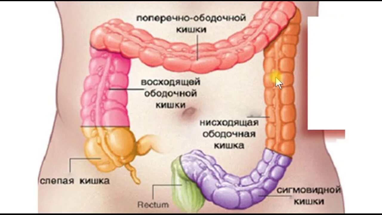 Отделы поперечно-ободочной кишки. Восходящий отдел поперечно-ободочной кишки. 3с поперечный отдел ободочной кишки. Восходящий и поперечный отделы ободочной кишки. Боль в слепой кишке
