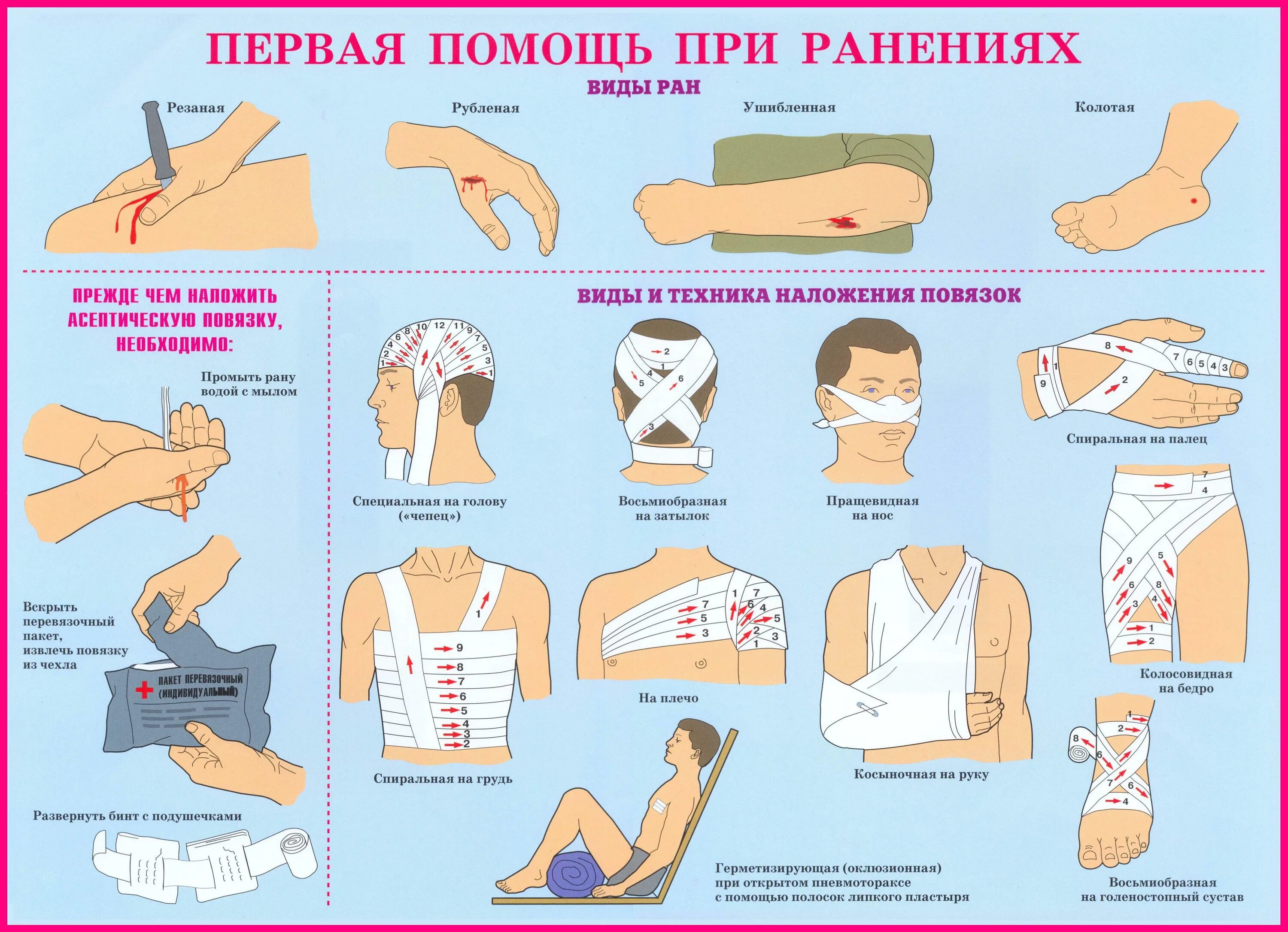 Оказание первой помощи при переломах и кровотечениях. Оказание первой медицинской помощи при осколочных ранениях. Первый этап оказания первой помощи при ранениях. Принципы оказания медицинской помощи при ранениях. Оказание первой помощи при ранениях и кровотечениях.