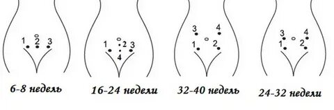 10 недель сердцебиение доплером