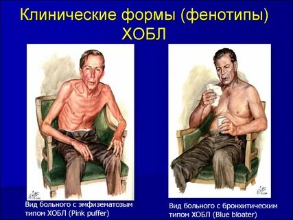 Тяжелое заболевание легких