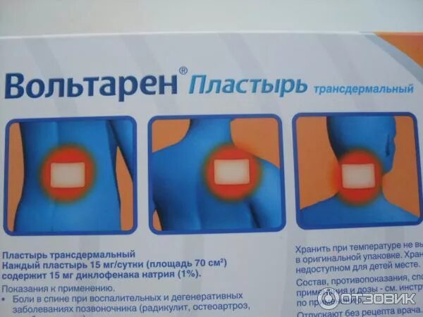 Можно ли использовать пластырь. Пластырь вольтарен при шейном остеохондрозе. пластырь при боли вольтарен. пластырь от хондроза спины. пластырь вольтарен от боли в шее.