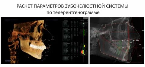 Расчет кт