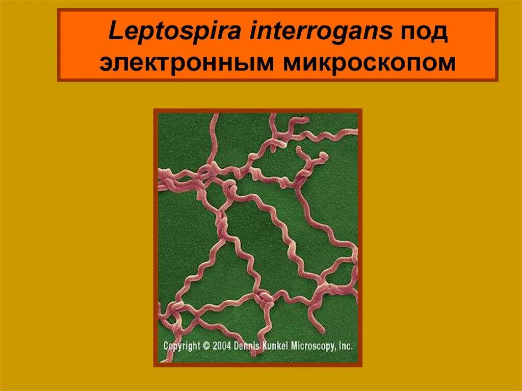 Лептоспироз инфекционный. Лептоспиры морфология микробиология. Возбудитель лептоспироза морфология. Leptospira микробиология. Патогенные лептоспиры.