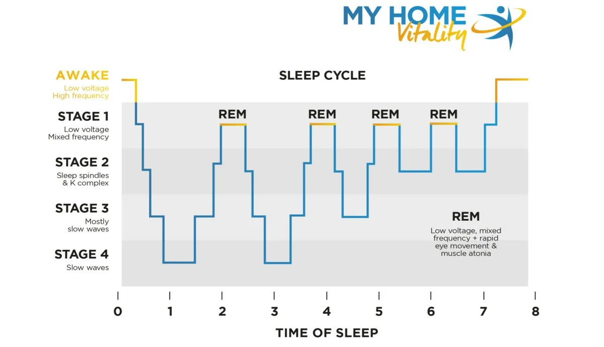 5 Stages of Sleep. Sleep phases. Циклы сна Rem. Rem Sleep phase.