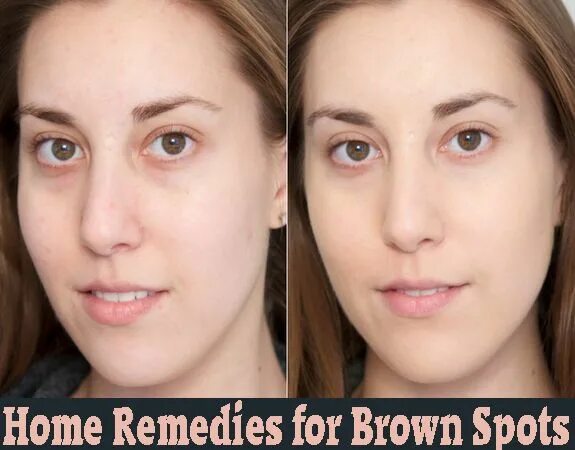 Harley Street skin expert launches 40-minute face lift that lasts 18 months