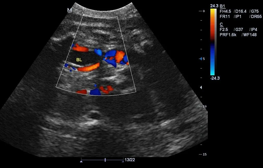 Темнов узи. УЗИ-допплер Миндрей. УЗИ внутренних органов. УЗИ ультразвук. УЗИ изображение.