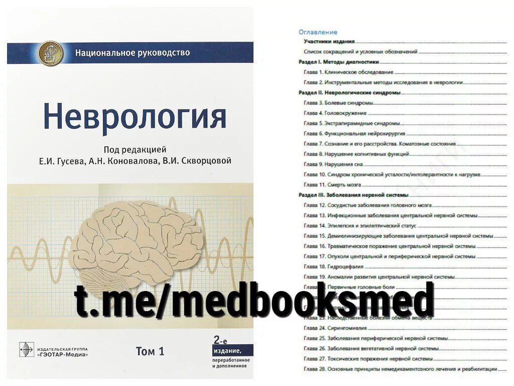 Национальное руководство по неврологии 2022. Гусева е.и., Коновалова а.н неврология. Национальное руководство. Том 1. Неврология : национальное руководство. Том 1. Клинические рекомендации неврология.