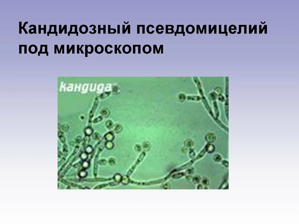 Обнаружены споры и мицелий. Candida дрожжевые клетки псевдомицелий. Candida псевдомицелий бластоспоры. Мицелий псевдомицелий дрожжевые клетки. Мицелий дрожжеподобных грибов.