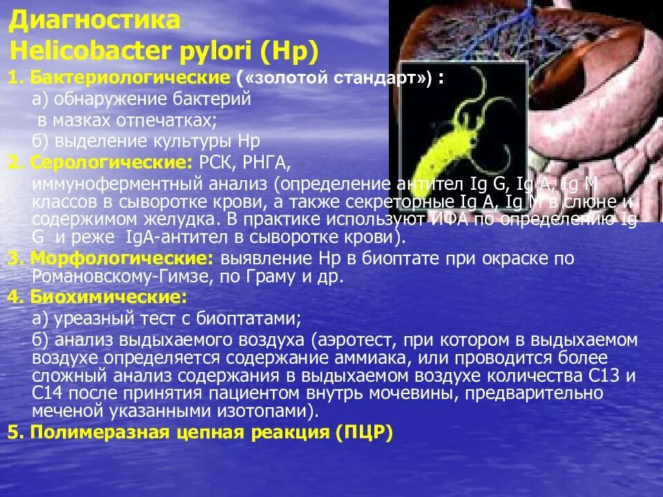 Ифа helicobacter pylori. Золотой стандарт обнаружения хеликобактер. инвазивные helicobacter pylori. методы исследования helicobacter pylori. неинвазивные методы хеликобактер пилори.