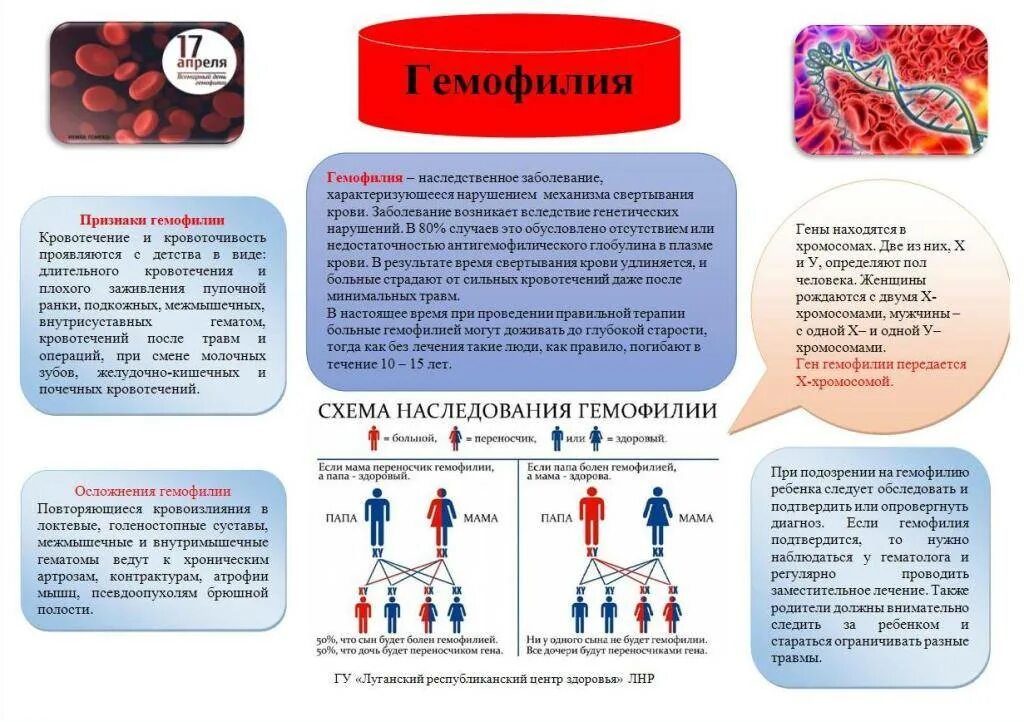 Рождение ребенка больного гемофилией