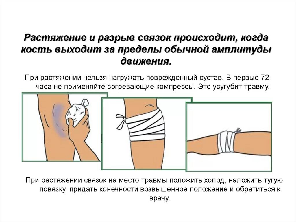 Первая при растяжении связок. При растяжении, разрыве связок. При растяжении связок нельзя. Что нельзя делать при растяжении связок.