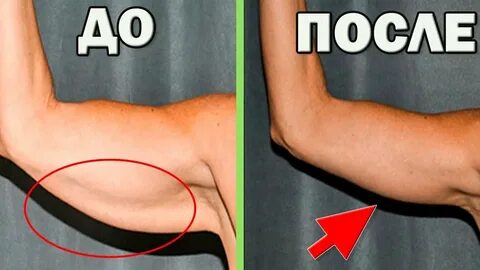 Как убрать под руками кожу