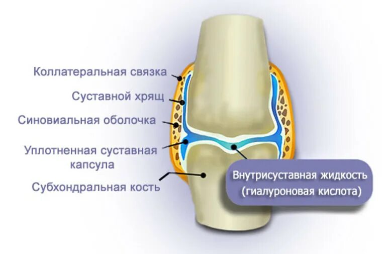 Синовиальная жидкость в коленном суставе гиалуроновая кислота. Введение гиалуроновой кислоты в сустав. Введение гиалуроновой кислоты в голеностопный сустав. Механизм действия гиалуроновой кислоты в сустав.