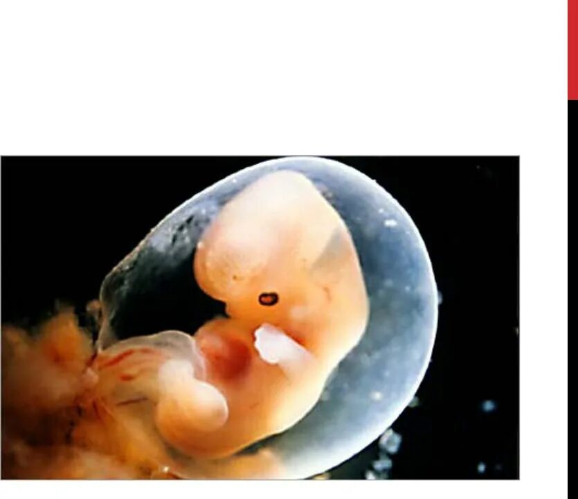 Эмбрион по неделям беременности 6-7 недель. Человеческий зародыш 6 недель. Эмбрион человека 5-6 недель. 6 недель беременности что происходит с мамой