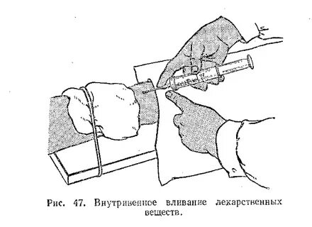 Парентеральное введение лекарственных средств внутривенные инъекции
