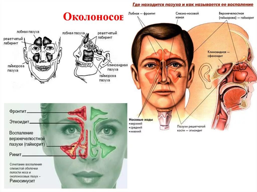 Куда в основном. Околоносовые пазухи носа анатомия. Строение носовой полости гайморовой пазухи. Строение носа и гайморовых пазух. Пазухи околоносовые и нос строение.