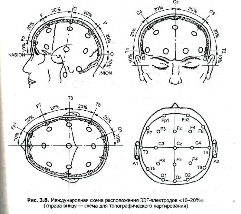 Система ээг. Электроэнцефалография схема 10 20. Энцефалография схема расположения электродов. Электроэнцефалография головного мозга (ЭЭГ). Международная схема электродов ЭЭГ.
