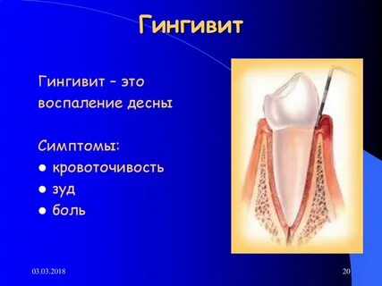 Gingivitis перевод с латинского