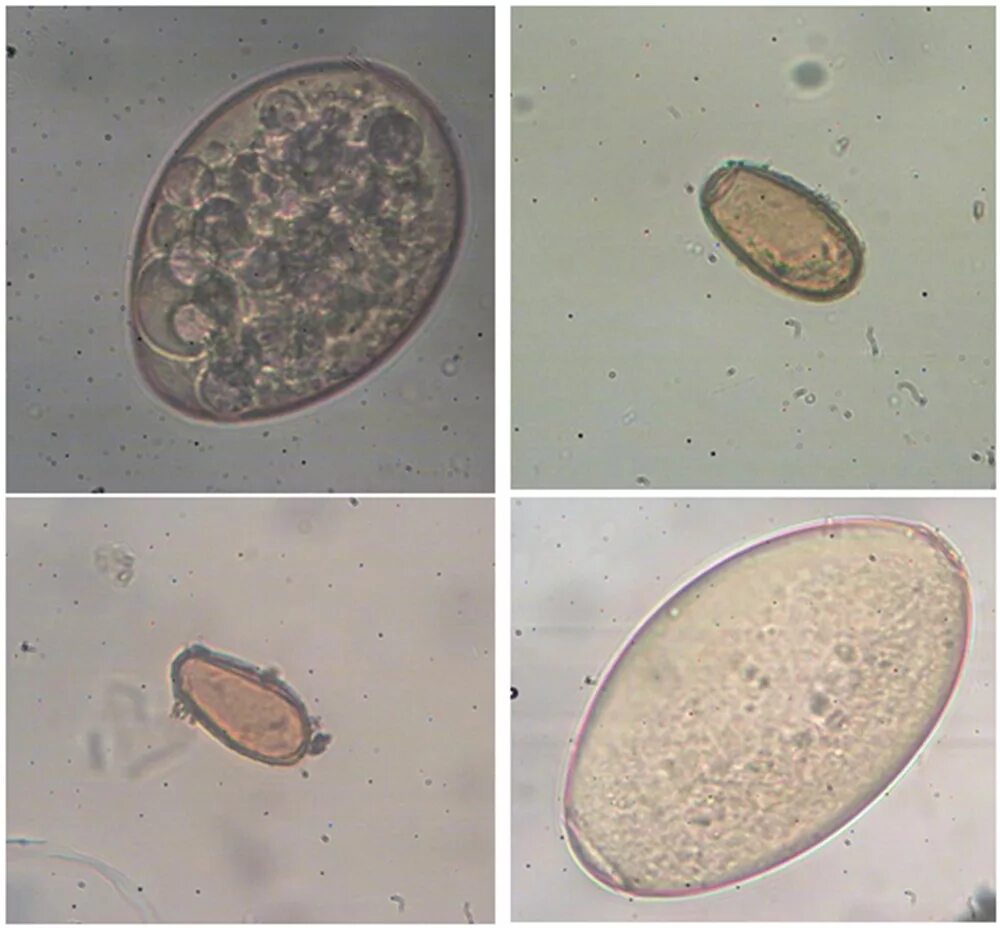 Яйца гельминтов микроскопия. Микроскопия кала яйца гельминтов. Яйца трематод в микроскопе. Купить яйца глист