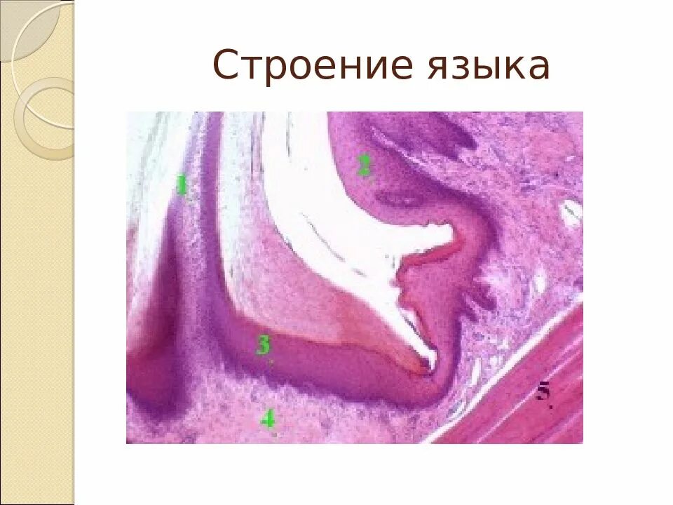 Слизистая полости рта гистология. Эпителий ротовой полости. Гиперемированная слизистая оболочка рта. Клетки слизистой полости рта