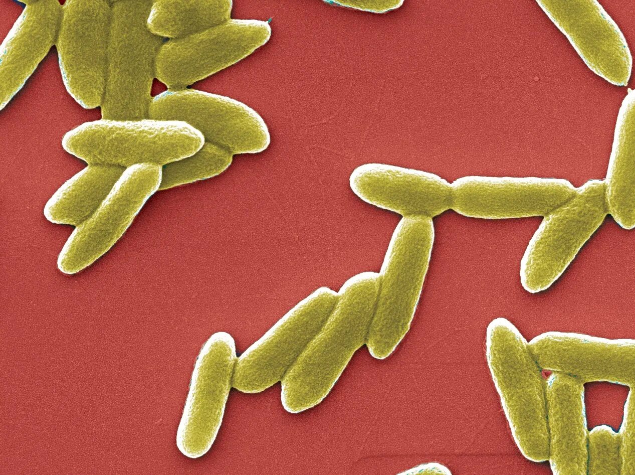 Бактерия Pseudomonas aeruginosa. Палочки рода Pseudomonas. Pseudomonas aeruginosa (синегнойная палочка). • Синегнойная палочка (p. aeruginosa).