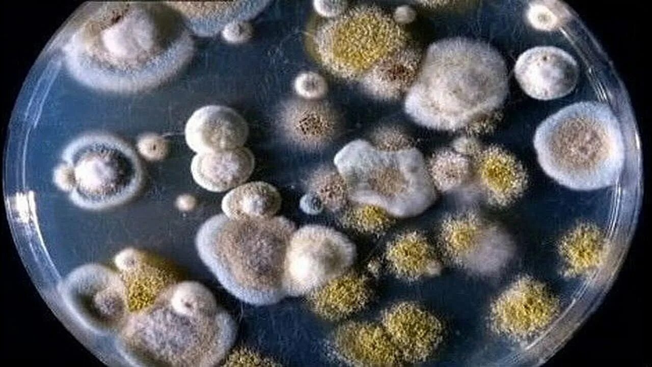Аллергены плесневых грибов. Плесневые грибы бактерии. Споры плесневых грибов аллергия. Плесневые грибки аллергены.