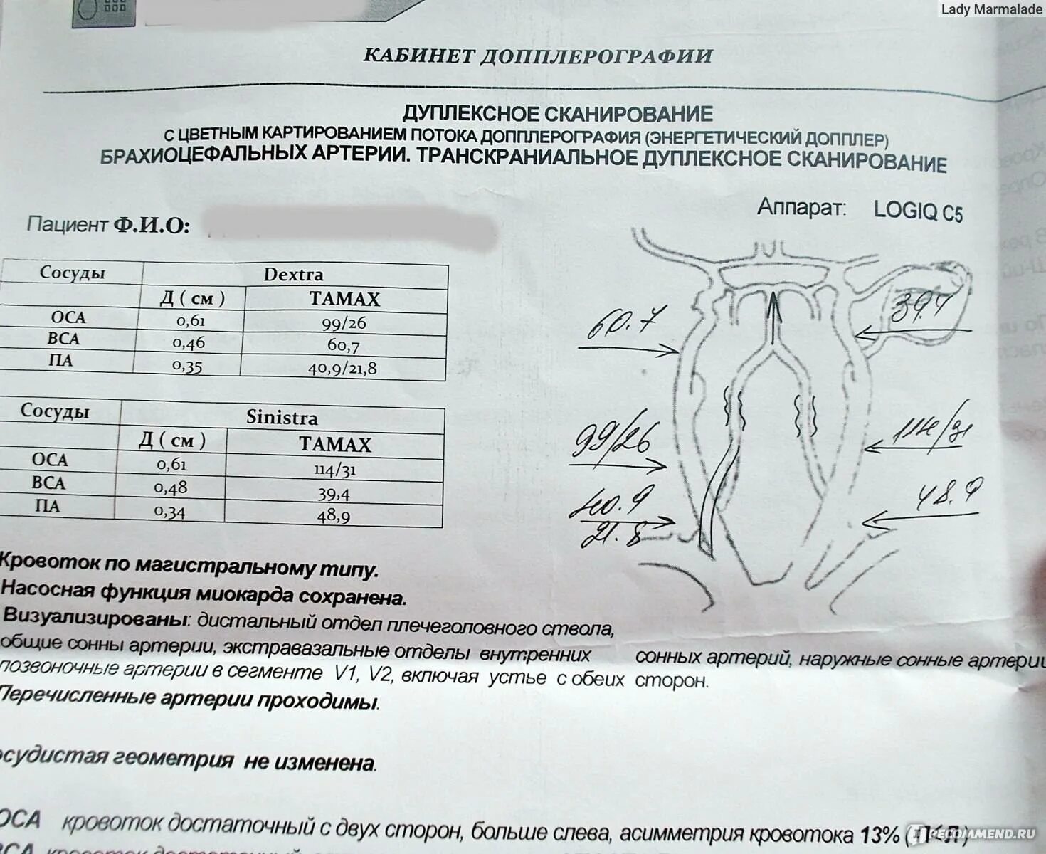 Бца с функциональными пробами. Расшифровка узи брахиоцефальных артерий норма. узи шейных артерий расшифровка. бца узи сосудов шеи расшифровка. протокол узи брахиоцефальных артерий норма.