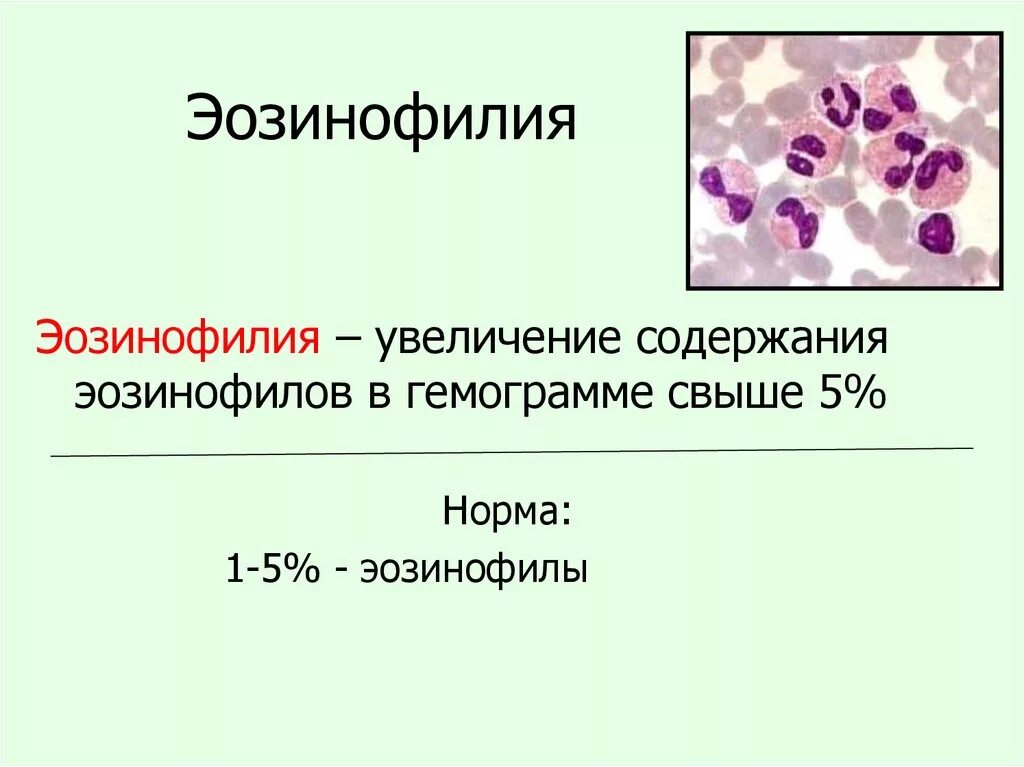 Эозинофильный лейкоцитоз картина крови. Эозинофилия периферической крови. Норма эозинофилов в периферической крови. Повышение эозинов в крови. Повышен процент эозинофилов в крови