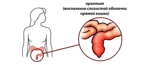 Үлкен араб бөксесі