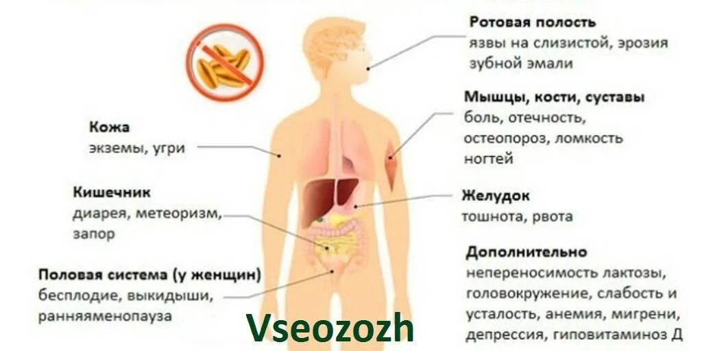 Целиакия симптомы у взрослых. Глютеновая непереносимость признаки. неусваиваемость глютена симптомы. непереносимость глютена симптомы у взрослых. целиакия внекишечные симптомы.