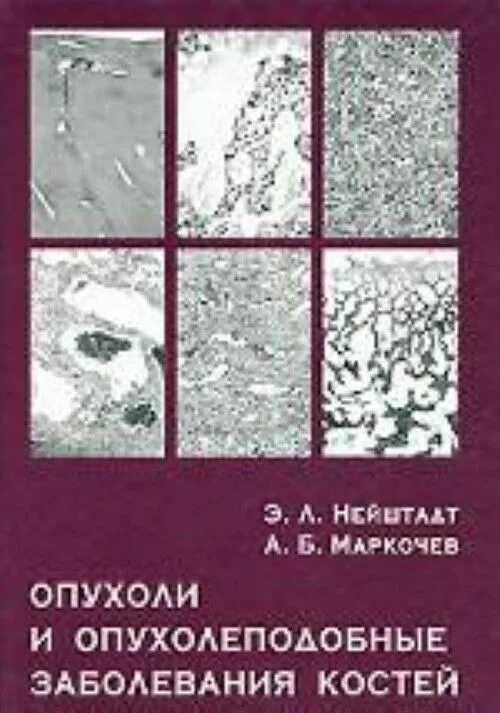 Нейштадт опухоли и опухолеподобные заболевания костей. Опухоли и опухолеподобные образования костей книга. Нейштадт э кости книга. Книги опухоль