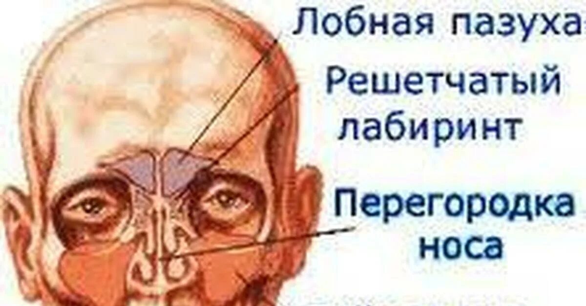 Решетчатый лабиринт. Пазухи носа решетчатый лабиринт. решетчатый лабиринт носа анатомия. лобная пазуха решетчатого лабиринта. решетчатый лабиринт верхнечелюстных пазух.