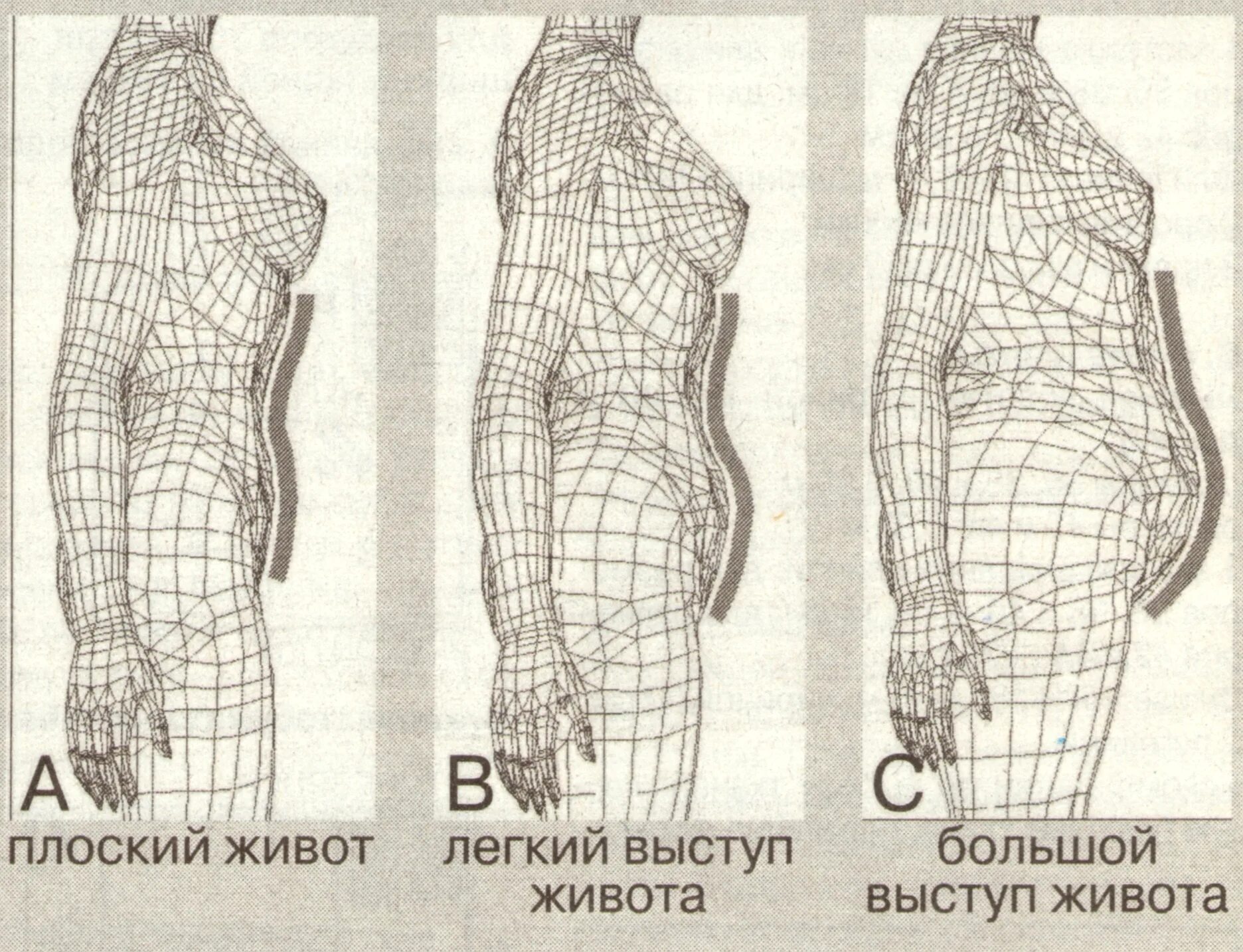 Виды животов у мужчин. Форма живота. Форма живота виды. Формы живота у женщин. Разные формы живота у женщин.