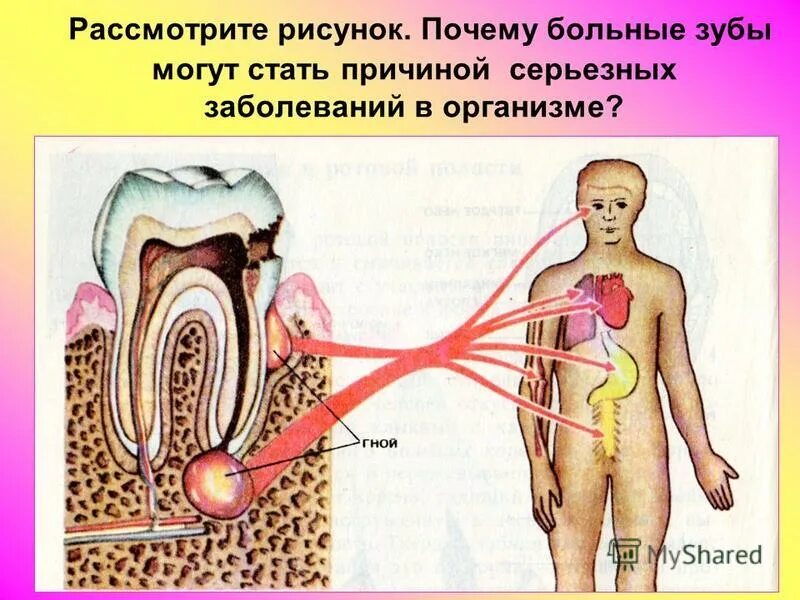 Как организм заболевает. Зубы и органы взаимосвязь. Зубы и внутренние органы. Влияние больных зубов на организм. Заболевания в организме и зубы.