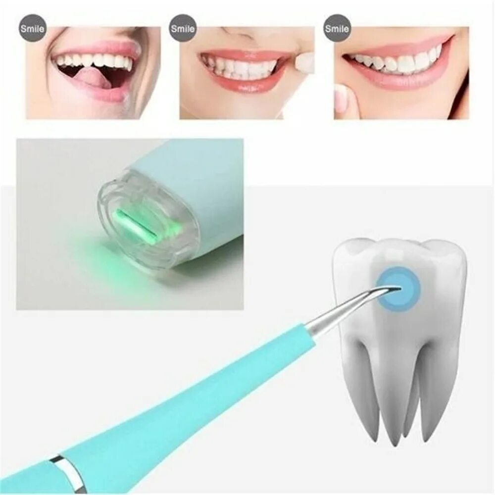 Как называется инструмент для чистки зубов ультразвуком. Прибор для снятия зуба. Приспособление для зубной нити. Прибор для снятия камней с зубов у стоматолога.