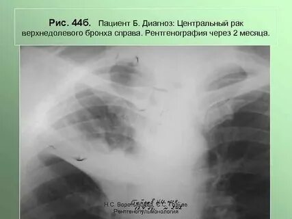 Диагноз центральный