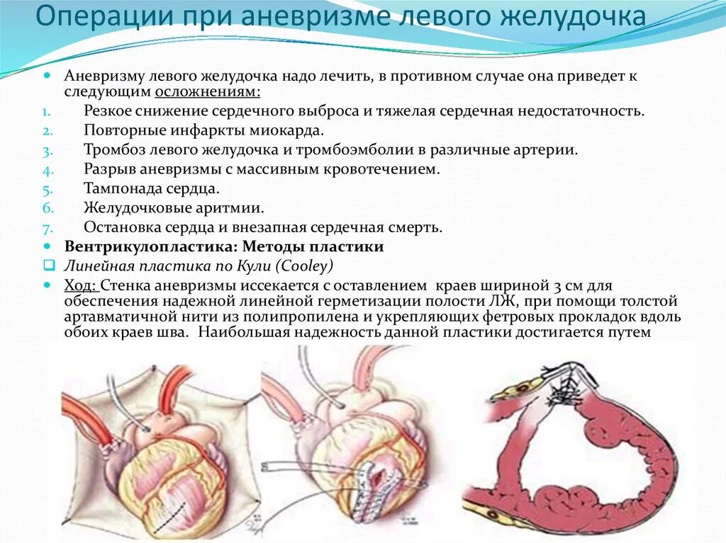 Аневризма показания к операции. Патогенез хронической аневризмы сердца. Признак аневризмы при инфаркте миокарда. Стенка хронической аневризмы сердца.