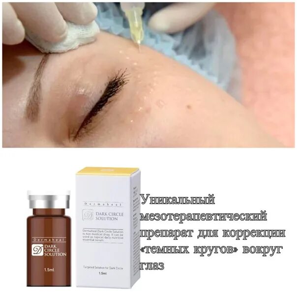 Dermaheal Dark circle solution. Dermaheal Dark circle solution мезотерапия. Дермахил от темных кругов под глазами. Дермахил темные круги.