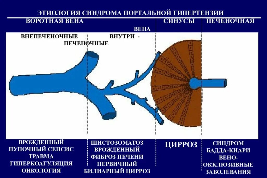 Расширенные вены печени. Подпеченочная портальная гипертензия. Портальная гипертензия тромбоз воротной вены. Портальная гипертензия внутрипеченочный блок. Портальная гипертензия патоморфология.